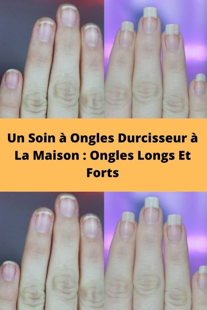 Croissance Ongles – Un soin durcisseur pour les ongles à la maison des ongles