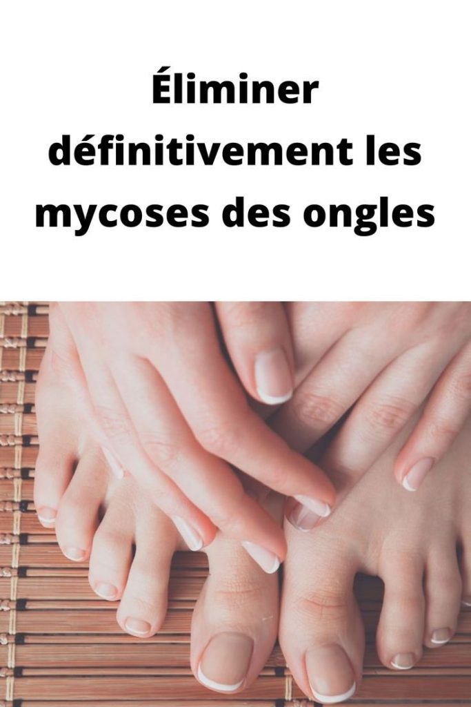 Éliminer définitivement les mycoses des ongles